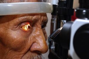 Lee más sobre el artículo Advierte Salud sobre riesgos para padecer glaucoma