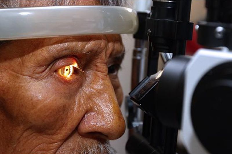 En este momento estás viendo Advierte Salud sobre riesgos para padecer glaucoma