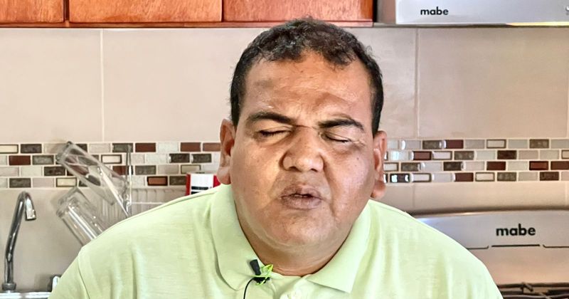 En este momento estás viendo Llaman a reconocer a la Sordoceguera como discapacidad única