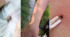 Lee más sobre el artículo Preocupa en Tecomán alta incidencia de enfermedades transmitidas por garrapatas