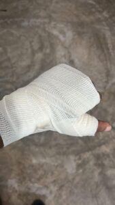 Lee más sobre el artículo Denuncian riesgo para trabajadores por desecho irresponsable de objetos punzocortantes