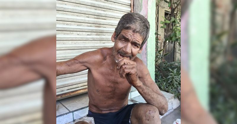 En este momento estás viendo Manada de perros ataca a adulto mayor en la colonia Indeco; resulta herido en ambas manos